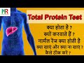 Total Protein Test Concepts