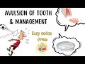 Managing Avulsed Teeth and Treatment Outcomes