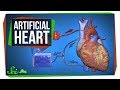 Understanding Open-Heart Surgery and Bypass Machines