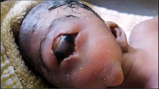20 Niños Con Defectos Geneticos Que Te Dejaran SIN PALABRAS