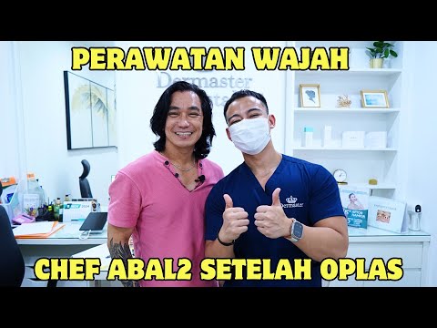 PERAWATAN WAJAH CHEF ABAL ABAL SETELAH MELAKUKAN OPLAS