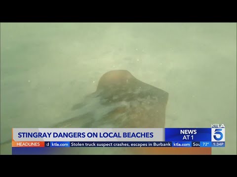 YouTube video thumbnail: How California Beachgoers Can Prevent and Treat Stingray Stings