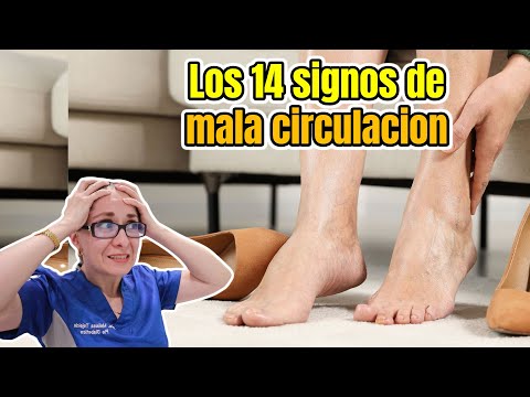 Los 14 signos de mala circulacion que no debes ignorar y te digo como resolverlo /Dra. Melissa