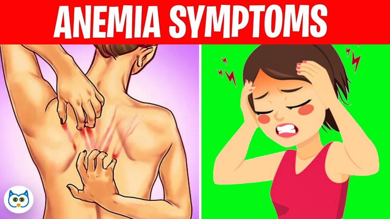 8 Silent Symptoms of Anemia You Shouldn’t Ignore