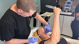 From Hidden to Radiant: Her Facial Transformation | Dr. Jason Emer