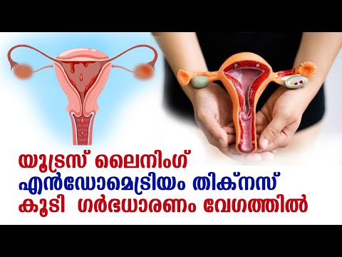 യൂട്രസ് ലൈനിംഗ്  ( എന്‍ഡോമെട്രിയം  തിക്നസ് ) കൂടി  ഗര്‍ഭധാരണം വേഗത്തില്‍ | endometrium lining uterus