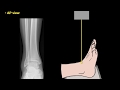 Ankle Anatomy and X-ray Views