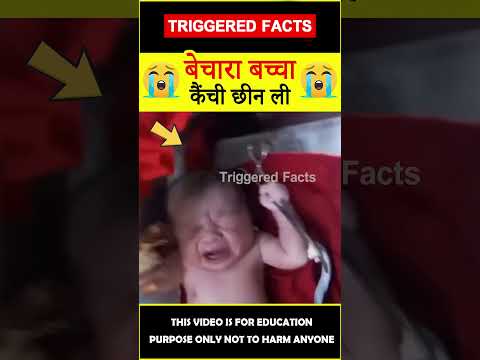 Infant surprises doctor #factsinhindi 😲कैंची छीन ली😲 #amazingfacts #triggeredfacts #shorts