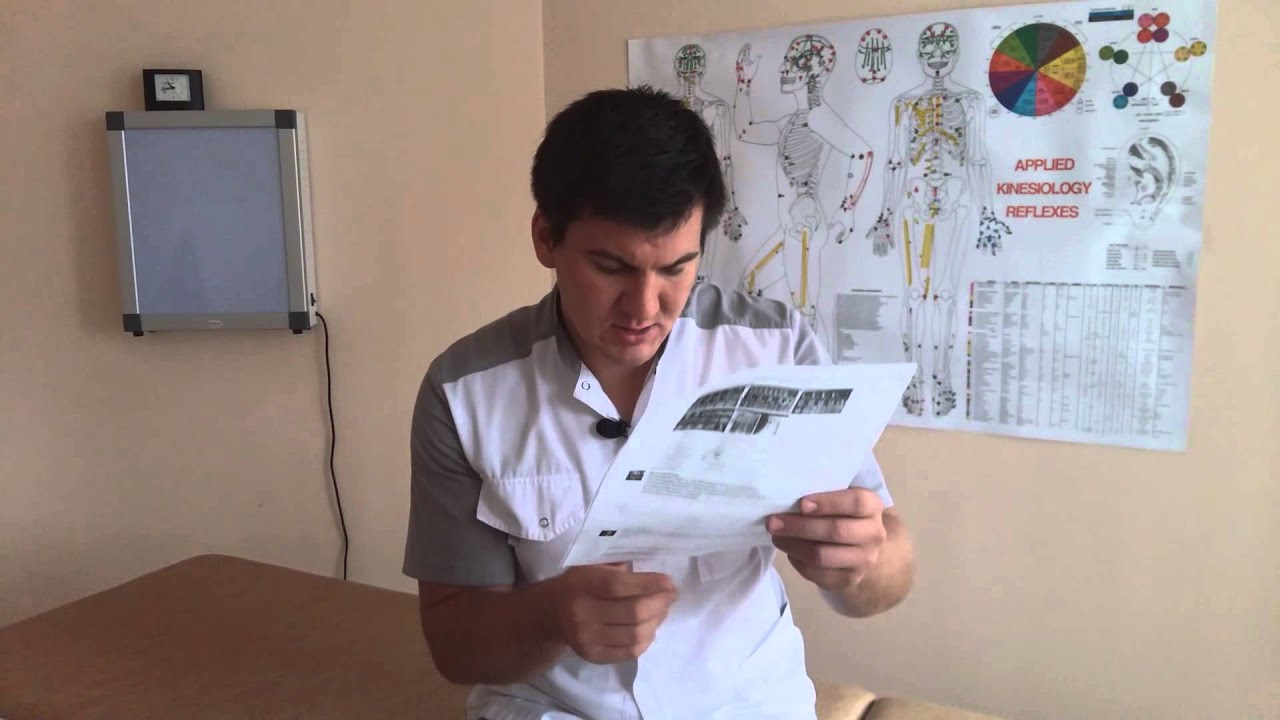 Ответы на вопросы. Сместился позвонок. О книге. Answers on questions. Shifted vertebra. About the book.