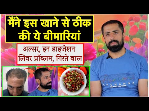 झड़ते बालों को ऐसे रोका, नए बाल आने लगे, stop hair fall naturally  || Technical Farming ||