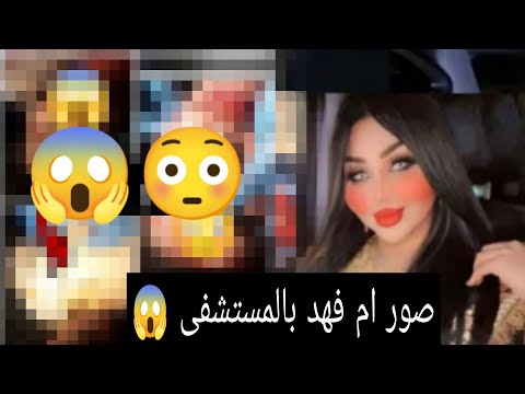 شاهد صور ام فهد من داخل المستشفى بالطب العدلي 😱الاول مره بالعراق.منو المسؤل شاهد الحقيقه بالكامل