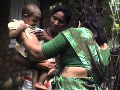 Association for Leprosy Education Rehabilitation & Treatment - India (ALERT INDIA)