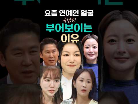 요즘 연예인들 왜 다 부어보일까?