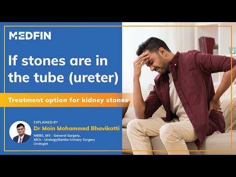 Treatment Options For Ureteric stones