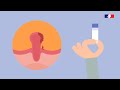 Dépistage et Détection du Cancer