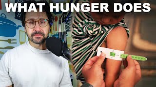 Why starving kids need special food