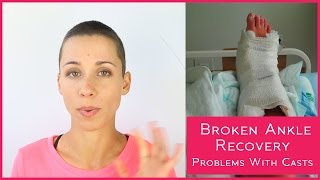 Broken Ankle Recovery -  Problems with Casts