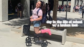 DAY IN THE LIFE AT SCHOOL W/ A BROKEN FOOT