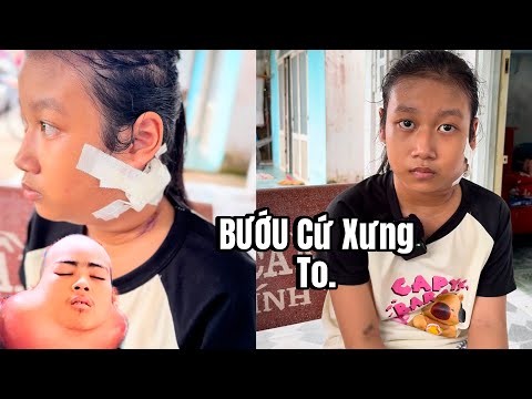 Bé Nhã Phải Bỏ Học Vì Căn Bệnh Bướu Cổ Xưng To Như Em Lương Vừa Mất .!