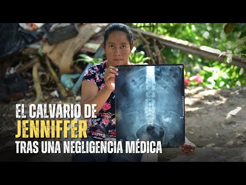 Negligencia médica: le dejaron un objeto y le perforaron el intestino varias veces