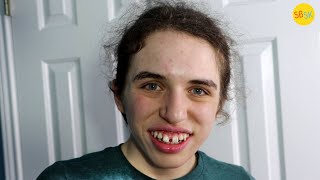Living with a 1 in a Billion Genetic Disorder