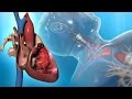 Understanding Right Heart Catheterization
