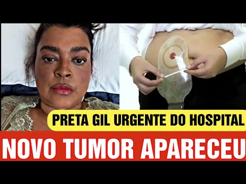 Preta Gil urgente do hospital! Mais um tumor apareceu e infelizmente o pior...