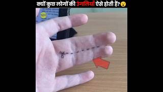 Why Some People Have Joint Fingers?