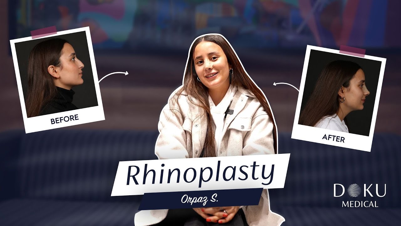 #Rhinoplasty – Nose Surgery Entire Process / Transform your look with Rhinoplasty!