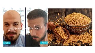 ملعقة حلبة ستجعل كل من حولك يتكلم عن طول شعرك و كثافته و لمعان مع ديدا عبد القدوس
