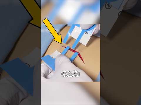 You’ll Never Need Stitches Again