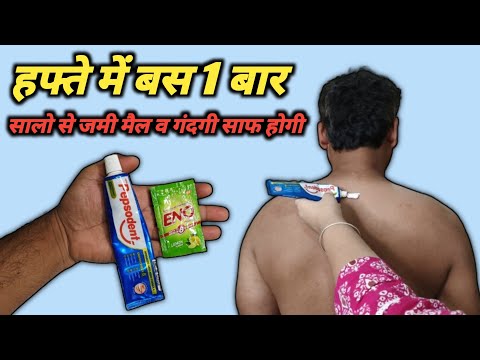 दुनिया का सबसे आसान तरीका जो हाथ पैर गर्दन को चमका देगा, 1 ही बार में 100% Result | Feet Brightening