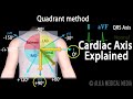 Understanding Cardiac Axis and QRS Complex