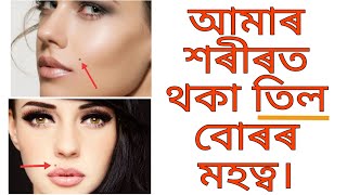আমাৰ শৰীৰত থকা তিল বোৰৰ মহত্ব। Significance of moles in our body|| Amazing AstroWorld