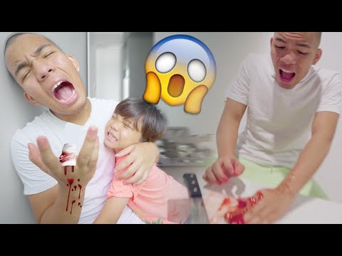 TES SEBERAPA SAYANG ADEKKU, SAAT PRANK JARIKU PUTUS!!!