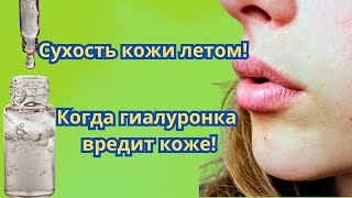 Сухость кожи летом. Как увлажнять кожу гиалуроновой кислотой.