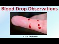 Blood Droplet Behavior and Clotting Factors
