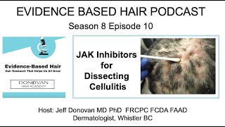 Season 8, Episode 10.  New Treatments for Dissecting Cellulitis: A Closer Look at Upadacitinib