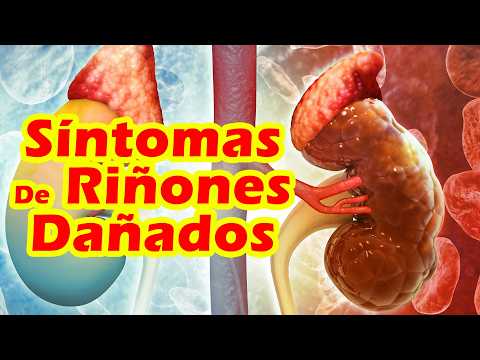 Si TUS RIÑONES ESTÁN EN PELIGRO El Cuerpo TE DA ESTOS SÍNTOMAS