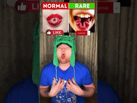 This Tongue Trick Only Few Can Do ๐
โ