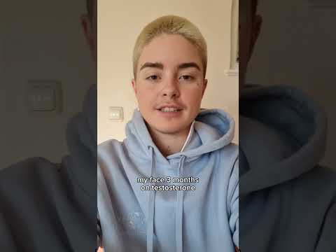 Facial changes on Testosterone #transmasc #nonbinary #nichtbinär #Testosterone