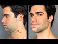 Mewing Technique and Its Effects