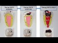 Dental Health and Tooth Decay