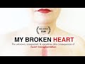 Heart Transplant Patient Experiences