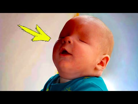 Он родился без глаз и мама бросила его. Вы не поверите, что с ним случилось!
