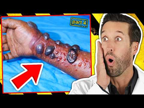 ER Doctor REACTS to World's Deadliest Diseases #4