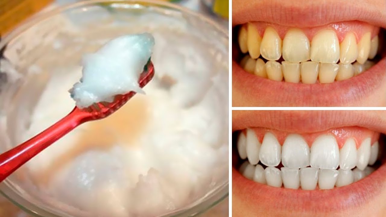 How to Naturally Whiten your Teeth at Home in 3 Minutes