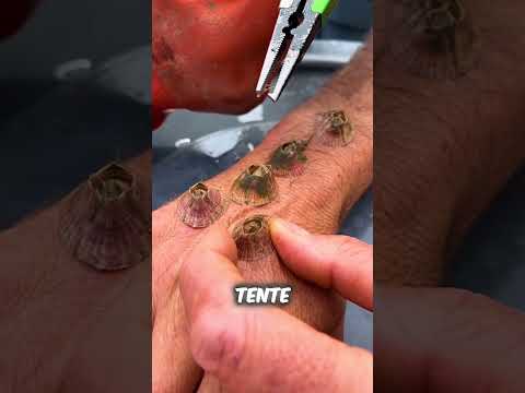 Ces bernacles ne veulent pas lâcher 😧🦠