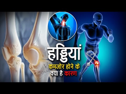 अगर आपकी हड्डियां बहुत कमजोर हो गई हैं, तो ये 1 चीज़ रोज़ खाओ!