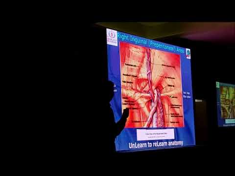 Endoscopic Anatomy of Inguinal Region